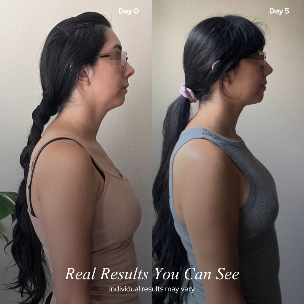 Cervly - Smart Neck Support Massager